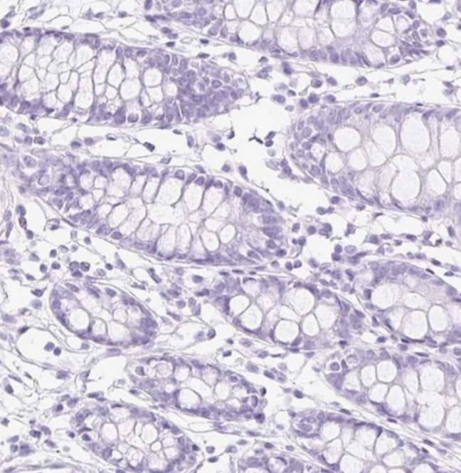 Claudin-16 Antibody - BSA Free