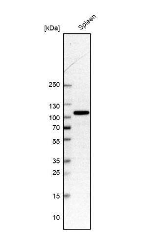 Hexokinase Type III Antibody