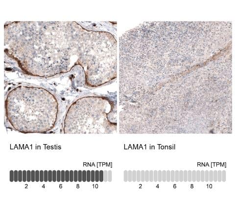 Laminin Antibody (CL2968)