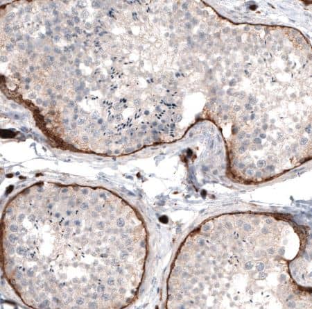 Laminin Antibody (CL2968)