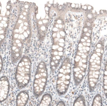 Laminin Antibody (CL2968)
