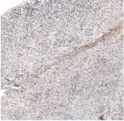 Laminin Antibody (CL2968)