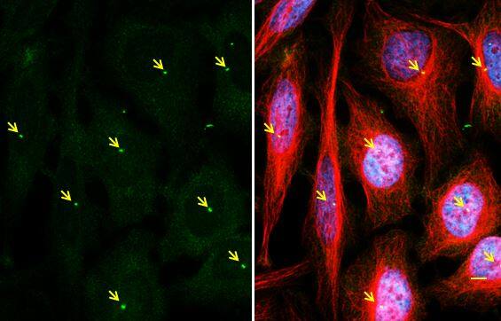 gamma Tubulin Antibody (4511)
