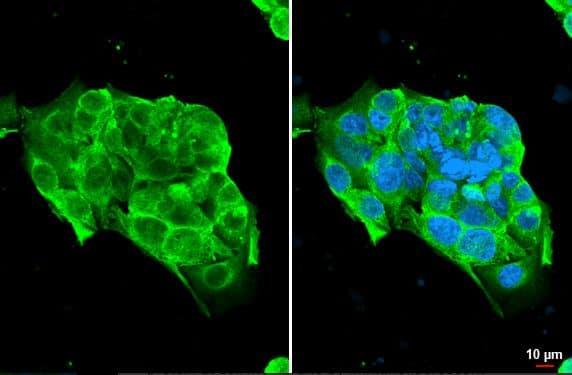 NKG2D/CD314 Antibody