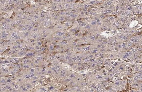 FOLR2 Antibody