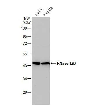 RNASEH2B Antibody (479)