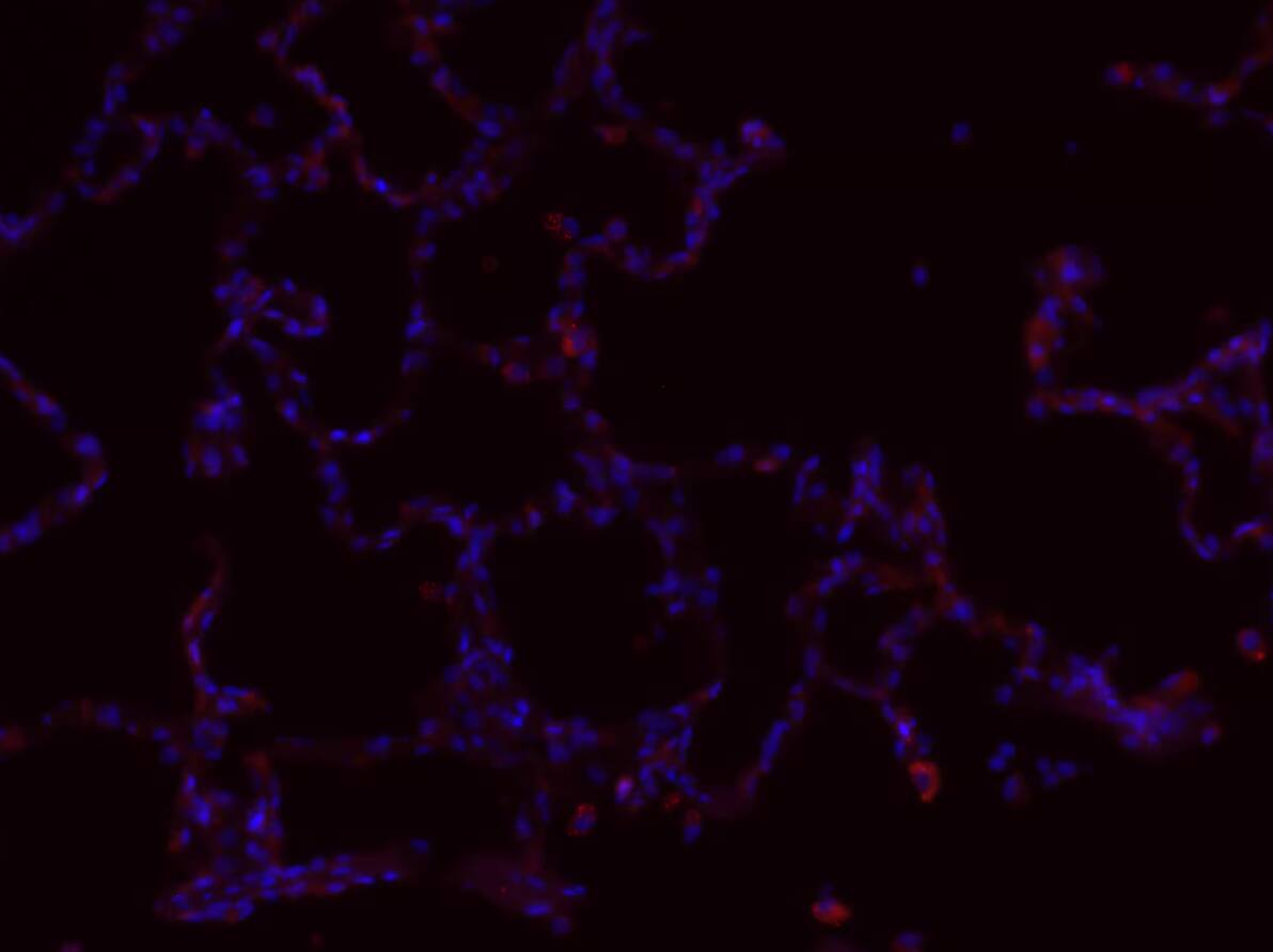 EpCAM/TROP1 Antibody (EGP40/1110) - (ECD)