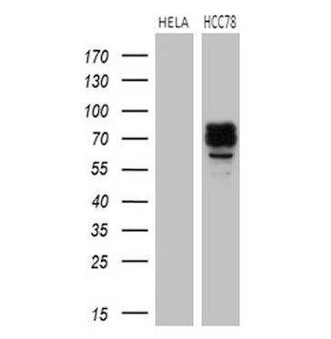 ROS Antibody (OTI1F3)