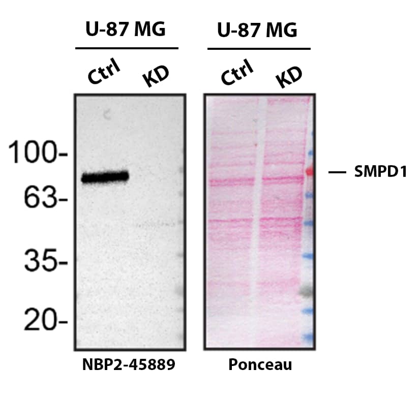 SMPD1 Antibody (OTI3H7) Western Blot Shows SMPD1 Specificity Using Knockdown Cell Line.