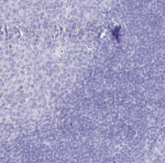 LRRC37A Antibody - BSA Free