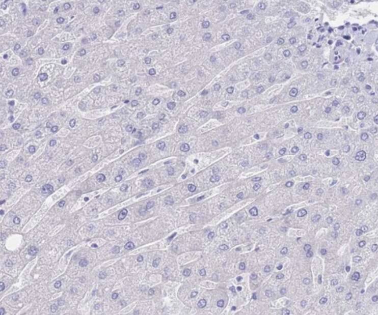 LRRC37A Antibody - BSA Free