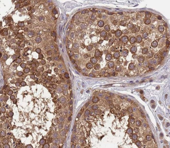 PP2A alpha Antibody - BSA Free