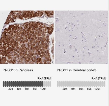 Trypsin 1/PRSS1 Antibody