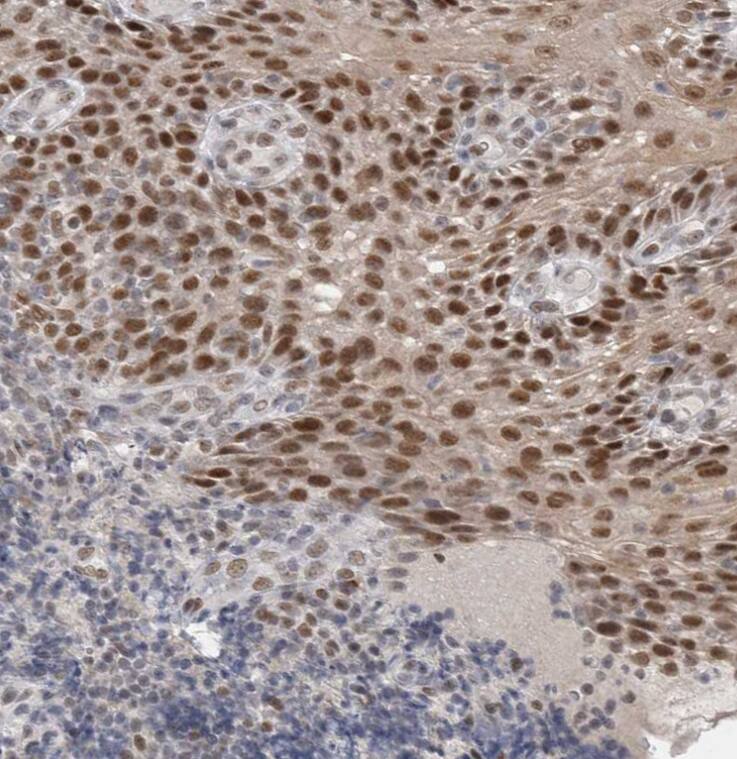 RECQL4 Antibody - BSA Free