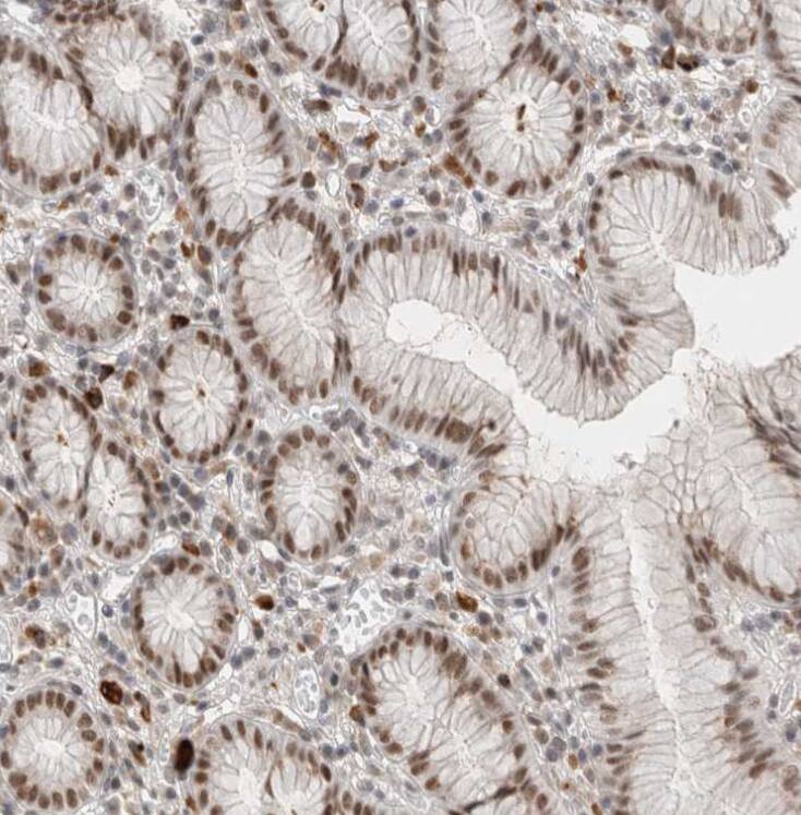 RECQL4 Antibody - BSA Free