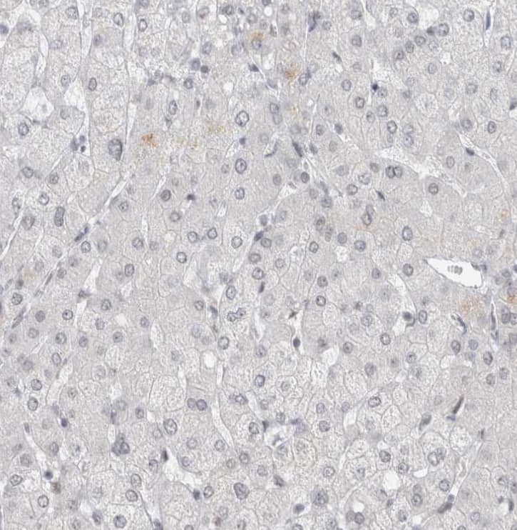 RECQL4 Antibody - BSA Free