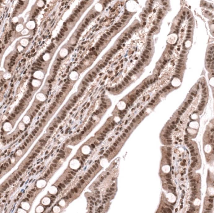 PARP2 Antibody - BSA Free