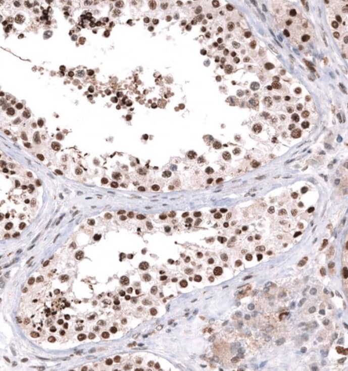 PARP2 Antibody - BSA Free