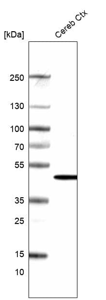 PAC1R Antibody Western Blot: PAC1R Antibody [NBP2-47340] -