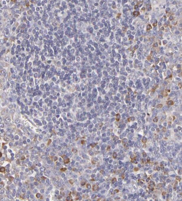 Calreticulin Antibody - BSA Free