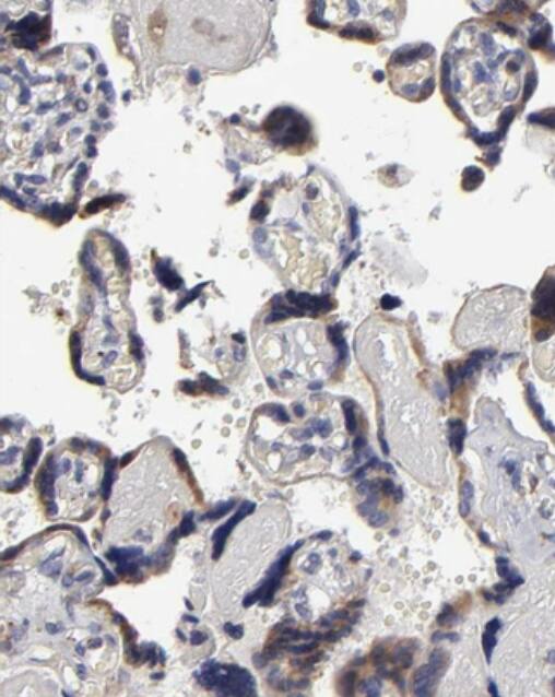 Calreticulin Antibody - BSA Free