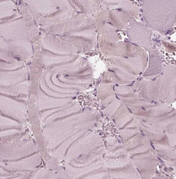 CCDC170 Antibody - BSA Free