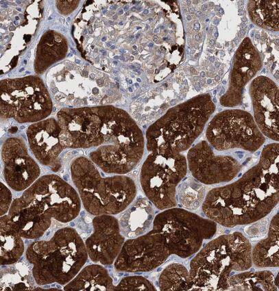 Fumarylacetoacetate hydrolase Antibody