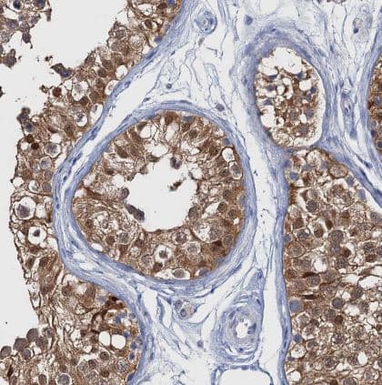Fumarylacetoacetate hydrolase Antibody