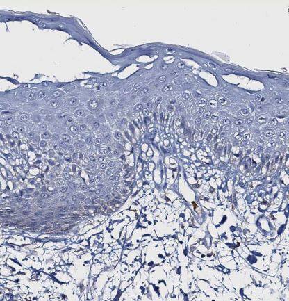 Fumarylacetoacetate hydrolase Antibody