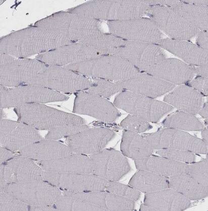 Tripeptidyl-Peptidase I/TPP1 Antibody - BSA Free