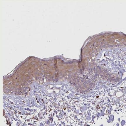 Desmoplakin Antibody