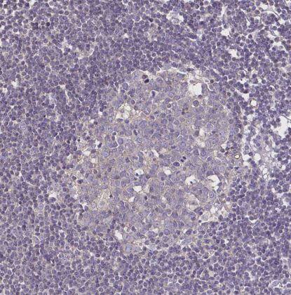 Desmoplakin Antibody