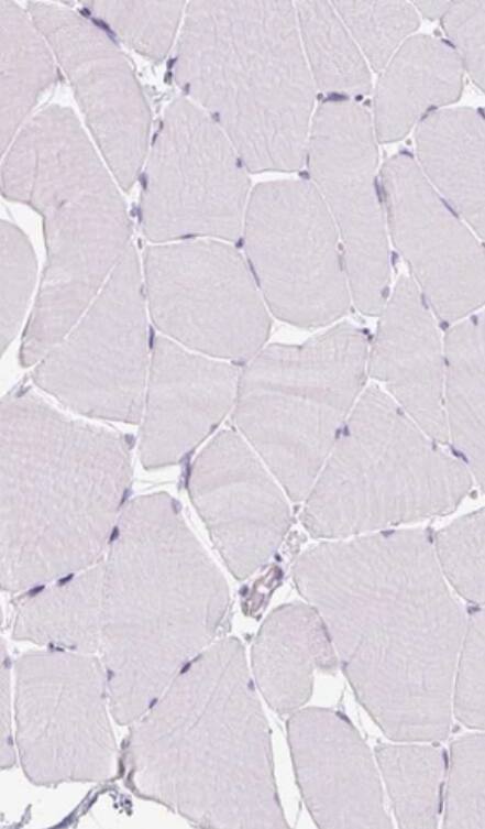 Reg3A Antibody - BSA Free