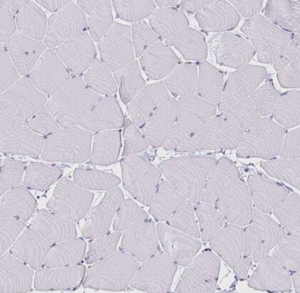 VSIG2 Antibody