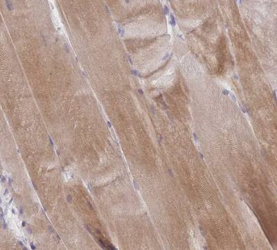 NDUFAF6 Antibody - BSA Free