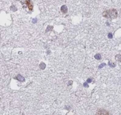 NDUFAF6 Antibody - BSA Free