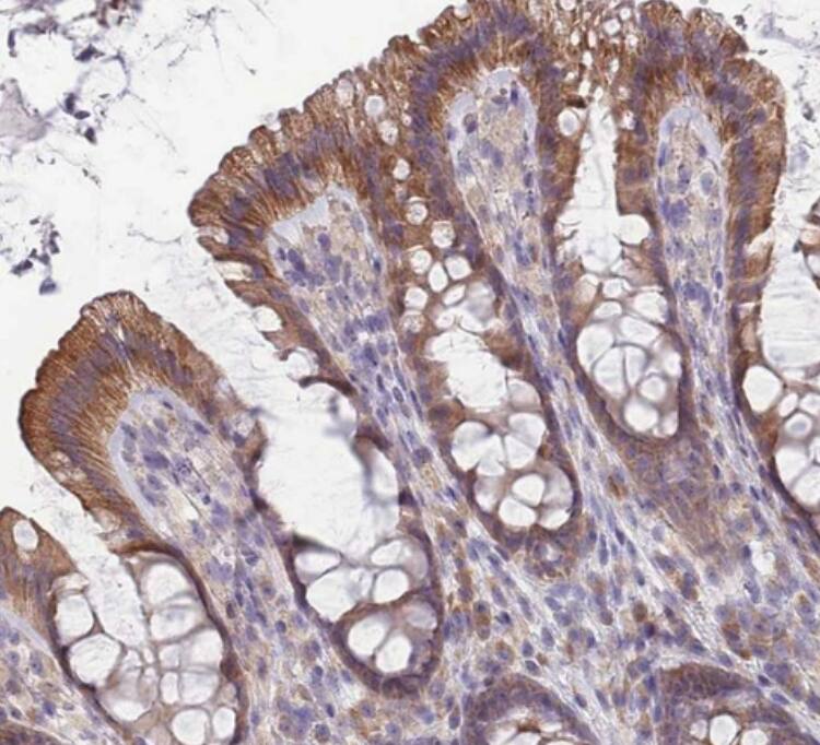 NDUFAF6 Antibody - BSA Free