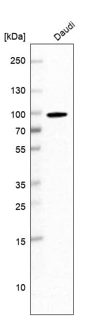 EWSR1 Antibody Western Blot: EWSR1 Antibody [NBP2-49020]