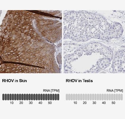 RhoV Antibody