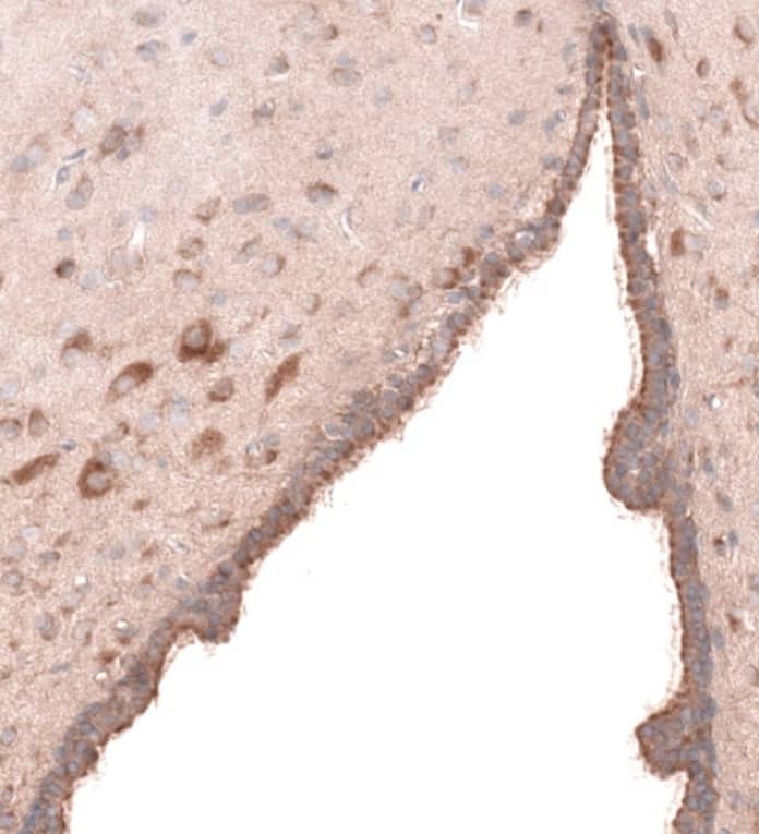 FOCAD Antibody - BSA Free