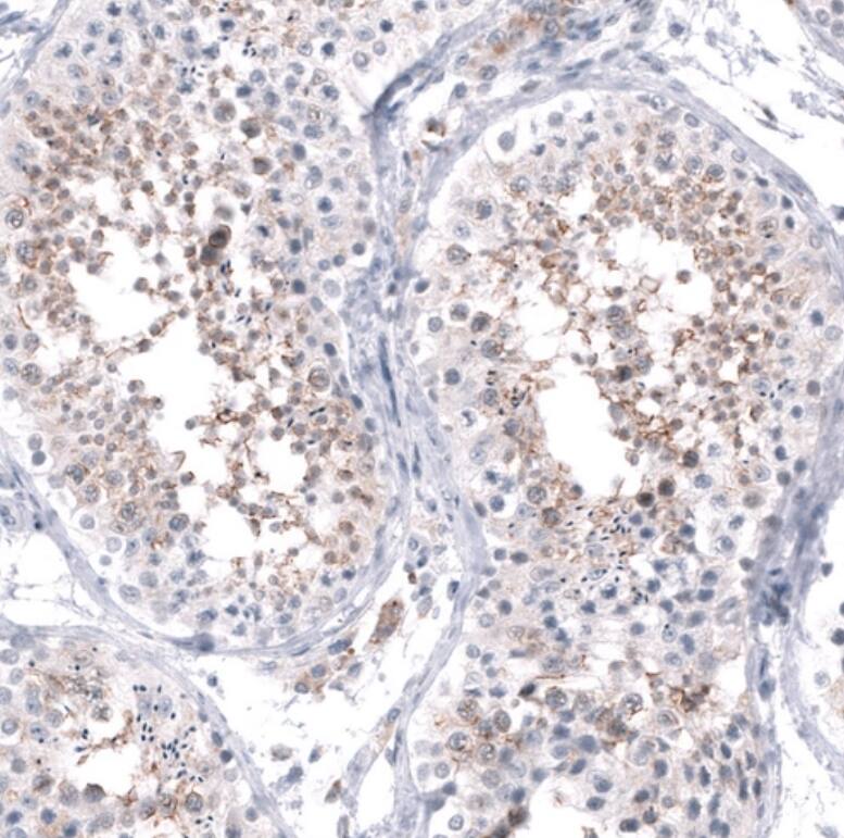 FOCAD Antibody - BSA Free