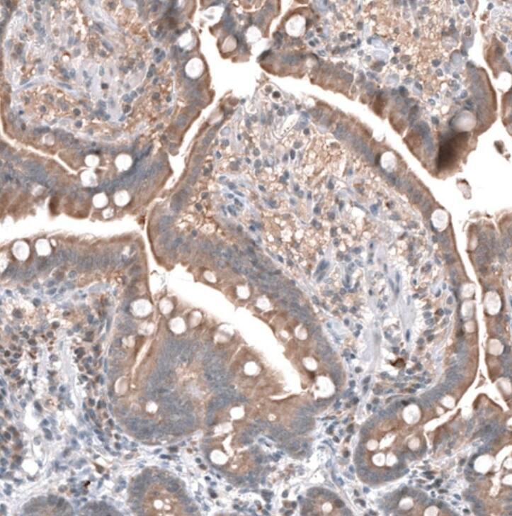 FOCAD Antibody - BSA Free