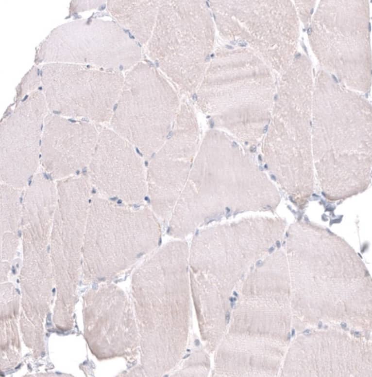 FOCAD Antibody - BSA Free