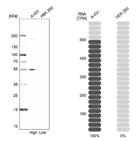 TROP-2 Antibody