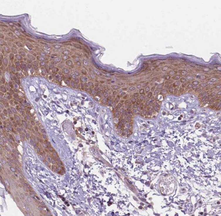 MAP4K6 Antibody - BSA Free