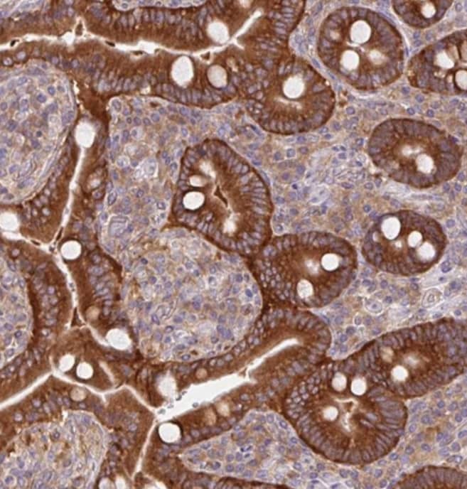 MAP4K6 Antibody - BSA Free