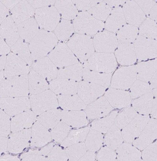 MAP4K6 Antibody - BSA Free