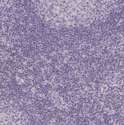 Triadin Antibody