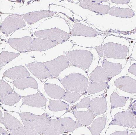 SHIP Antibody