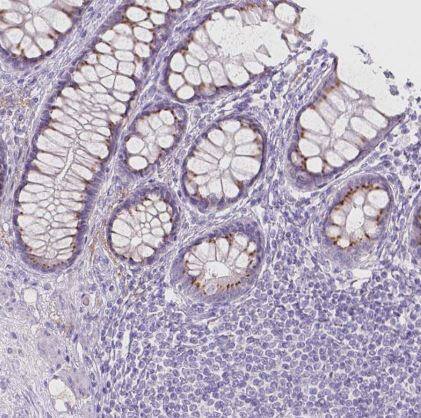 Galactose-3-O-sulfotransferase 2/GAL3ST2 Antibody
